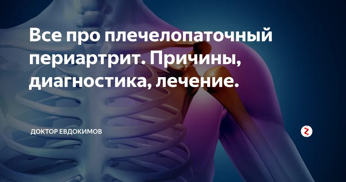 Форум периартрита
