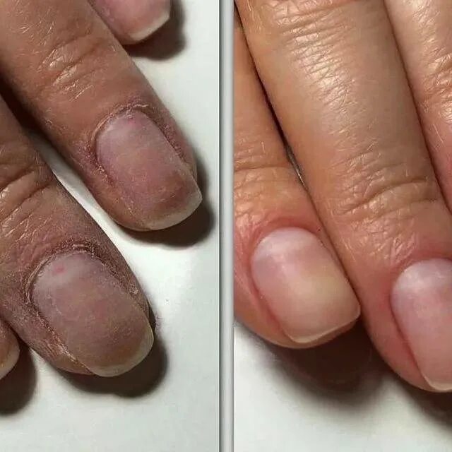 Восстановление ногтей после гель лака средства. Комбинированный маникюр без покрытия. Маникюр до и после. Комби маникюр без покрытия.