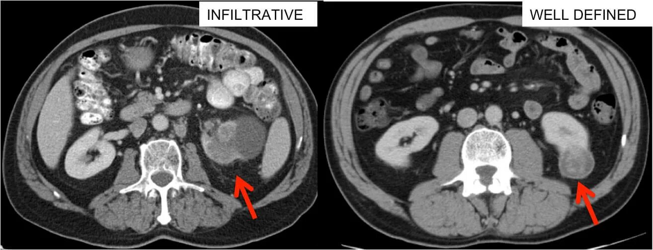 The images be scan. Ct scan report.