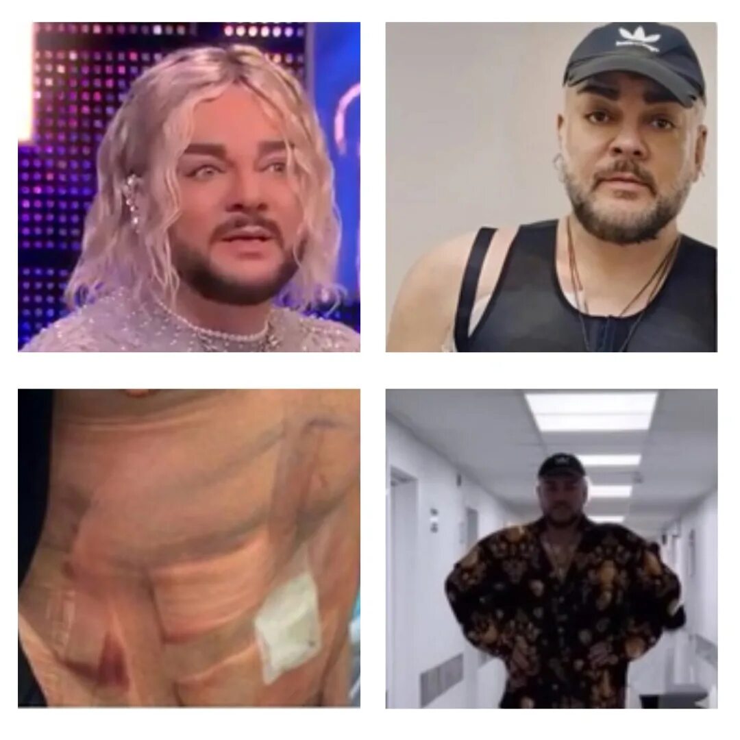 Киркоров после операции. Филипп киркоров 2023. Киркоров 2023. Киркоров после операции. Филипп киркоров сейчас 2023.