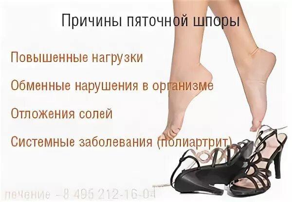 Шпоры причина появления. Какую обувь нужно носить при пяточной шпоре женщинам фото. Какую обувь носить при пяточной шпоре рекомендации фото. Алмаг плюс от шпоры. Какую обувь носить с шпорами ног для женщин.