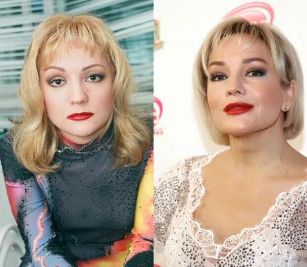 Татьяна буланова пластика. Буланова операция пластическая. Пластика булановой до и после. Татьяна буланова до и после. Татьяна буланова до пластики.