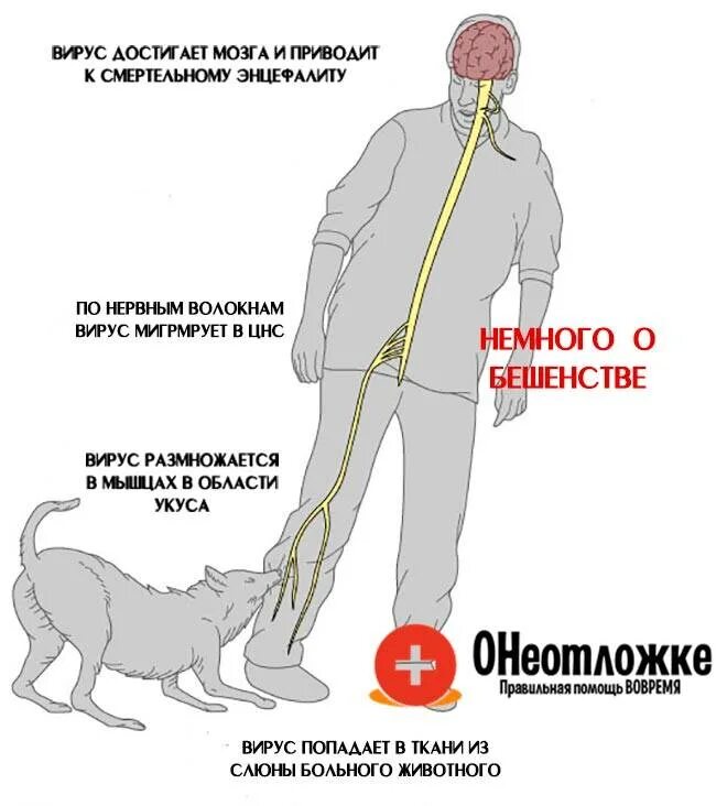 Симптомы укуса собаки человека. Бешенство у человека от укуса собаки. Симптомы бешенства у человека после укуса собаки. Инкубационный период бешенства у человека.