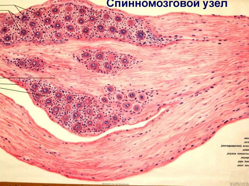 Спинной нервный ганглий. Спинальный ганглий гистология. Спинальный ганглий гистология препарат. Спинномозговой узел гистология препарат. Нервные клетки межпозвоночного ганглия препарат.