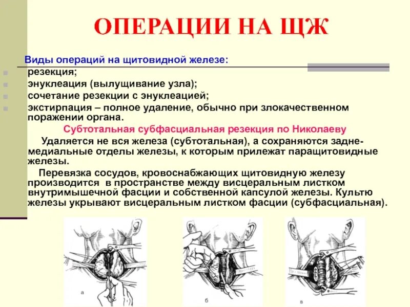 Почему появляются узлы. Энуклеация резекция щитовидной железы. Операция энуклеации узла щитовидной. Субтотальная субфасциальная резекция щитовидной железы. Операции на щитовидной железе топографическая анатомия.