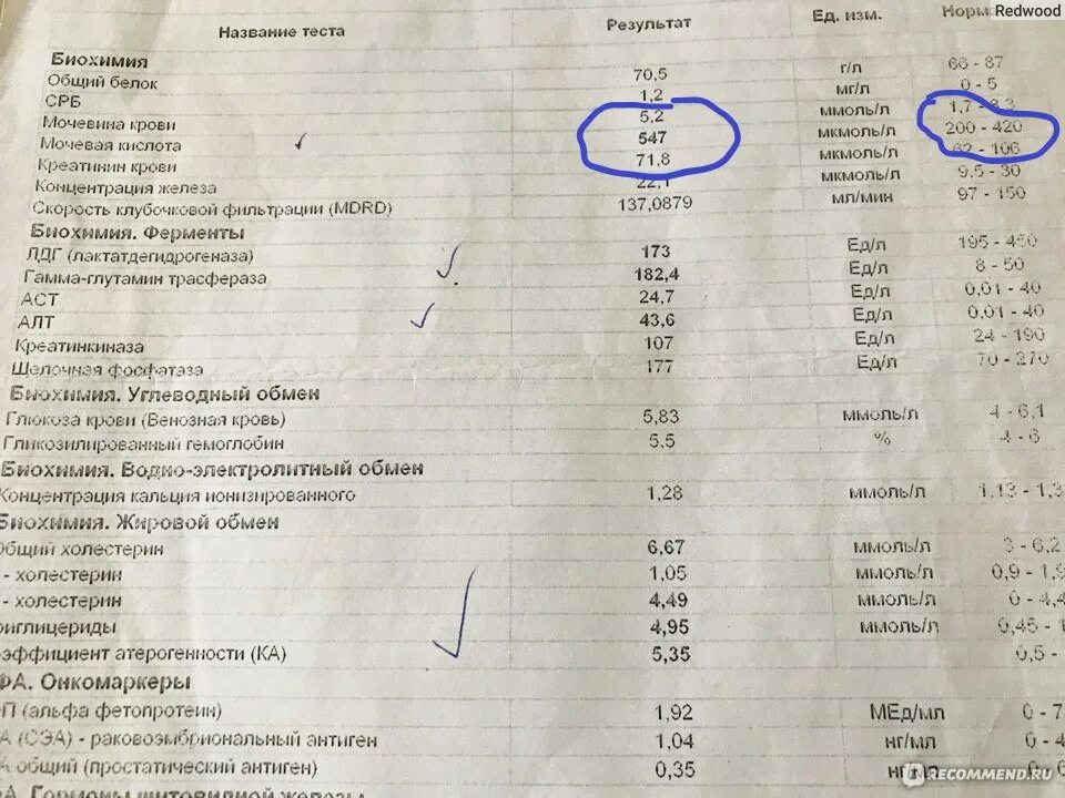 Какие анализы сдают при артрозе. Биохимия мочевая кислота норма. Мочевая кислота норма БХ крови. Анализ крови биохимия норма мочевая кислота. Анализ крови мочевая кислота норма у женщин.