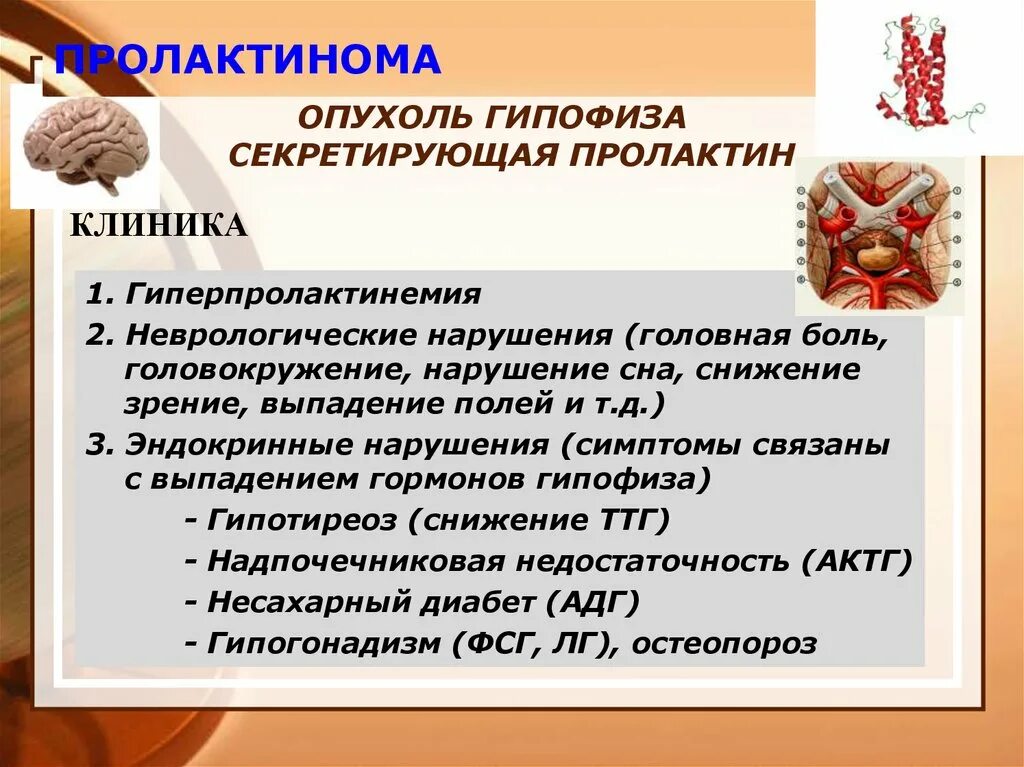 Гипофиза симптомы у женщин лечение прогноз. Пролактин продуцирующие опухоли гипофиза. лекарство при пролактиноме гипофиза. опухоли гипофиза клиника. симптомы микропролактиномы гипофиза.