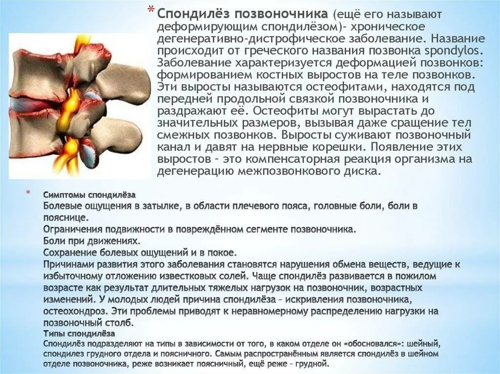 Спондилез поясничного отдела симптомы и лечение