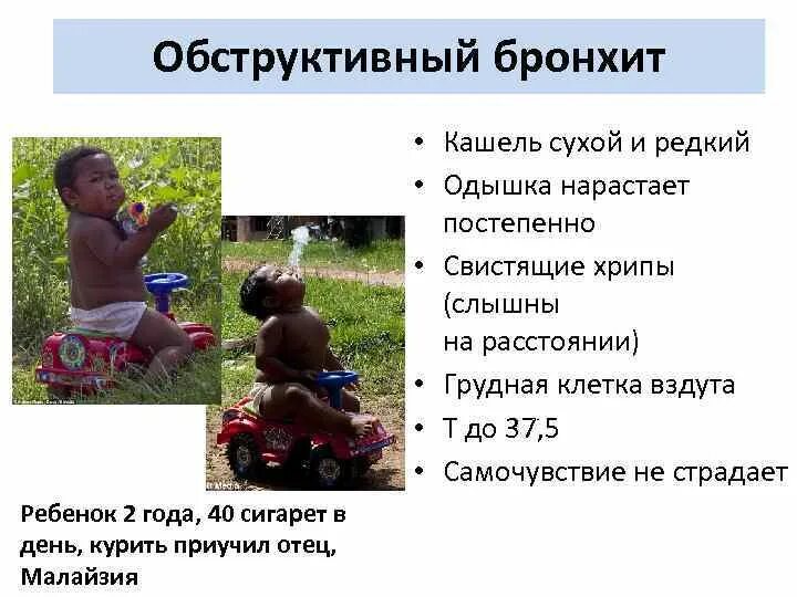Хрипы при выдохе без кашля. Хрипы при дыхании у ребенка. у ребёнка хрипы при дыхании и кашель. ребенок 2 года хрипит при дыхании. свистящие хрипы у ребенка при дыхании.