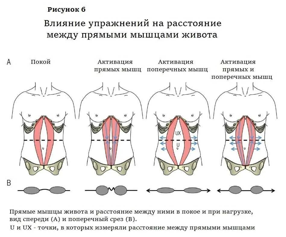 Как понять что мышцы слабые. Диастаз прямой мышцы живота клинические рекомендации. расхождение белой линии живота упражнения. поперечная мышца живота упражнения. расхождение брюшных мышц.
