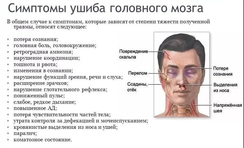 Сотрясение симптомы и лечение. Основной признак сотрясения головного мозга. Диагностические критерии сотрясения головного мозга. Критерии ушиба головного мозга. Признаками сотрясения головного мозга являются:.