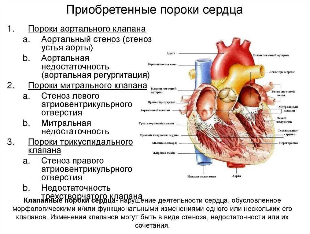 Миокард правого предсердия. Классификация приобретенных клапанных пороков сердца.. Морфологическая характеристика приобретенных пороков сердца. Разновидности приобретенных пороков сердца. Приобретенные клапанные пороки сердца.