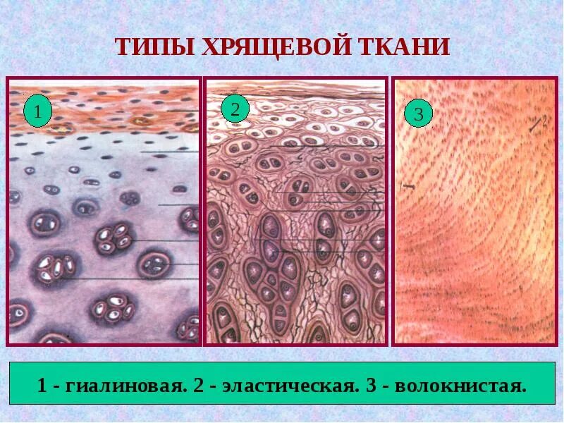 Вид соединительной ткани хряща