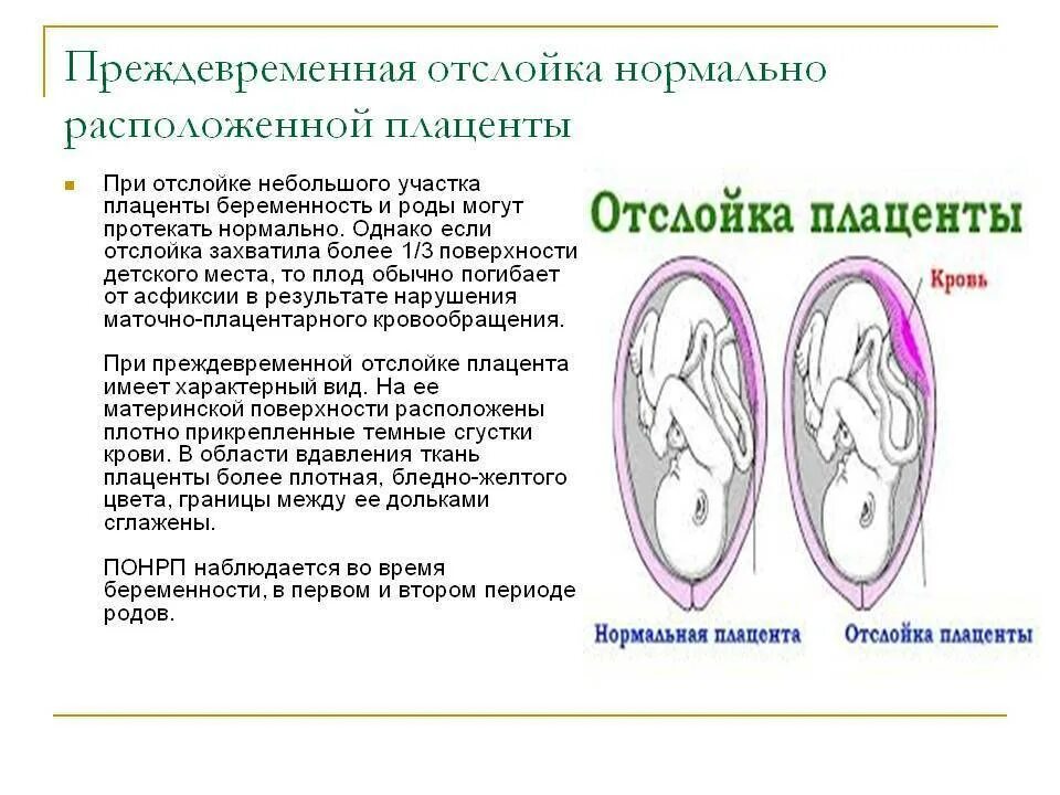 Что такое плацента и какова ее функция. Отслойка нормально расположенной плаценты симптомы. Симптомы отслойки плаценты на 7 неделе беременности. Что такое плацента отслойки плаценты при беременности. Отслойка плаценты при беременности в 1 триместре.