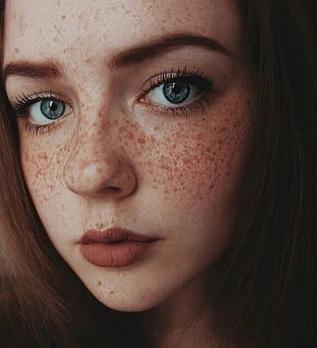 веснушки на лице. веснушки эфелиды. веснушки вода. красивые веснушки. веснушки на лице.