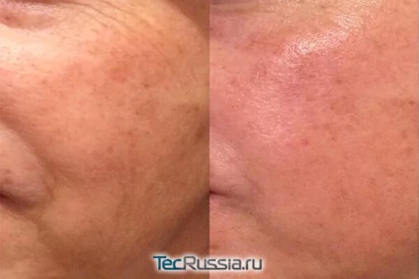 Цены "Клиника медицины кожи" на Спортивной в Санкт‑Петербурге - Яндекс Карты