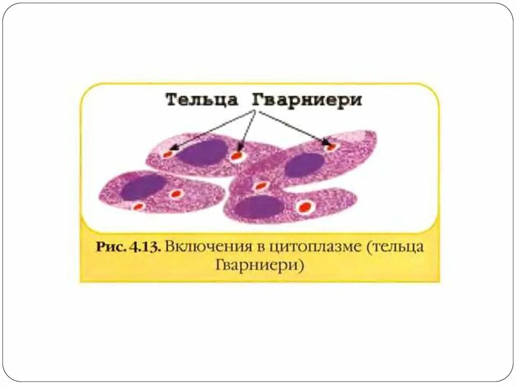 Тельца Гварниери при натуральной оспе. Включения Гварниери. Внутриклеточные тельца-включения. Внутриклеточные вирусные включения. Многочисленные мелкие тельца