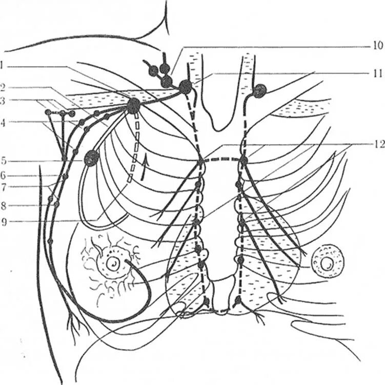 Удаление груди и лимфоузлов. Лимфатические узлы молочной железы анатомия. Лимфоотток грудной железы. Лимфоотток молочной железы топографическая анатомия. Квадранты молочной железы лимфоотток.