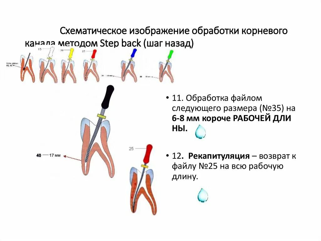 Определение корневых каналов. Инструментальная обработка корневых каналов. Методы обработки корневых каналов. Методы расширения корневых каналов. Стандартный метод обработки корневых каналов.