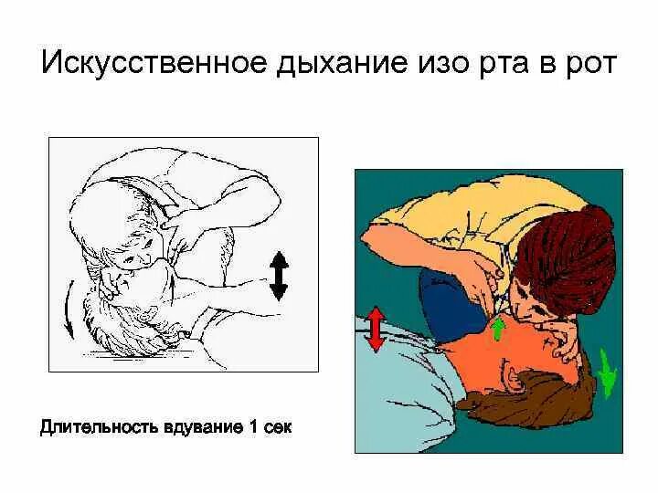 Искусственное дыхание проводится в случаях. Схема искусственного дыхания.