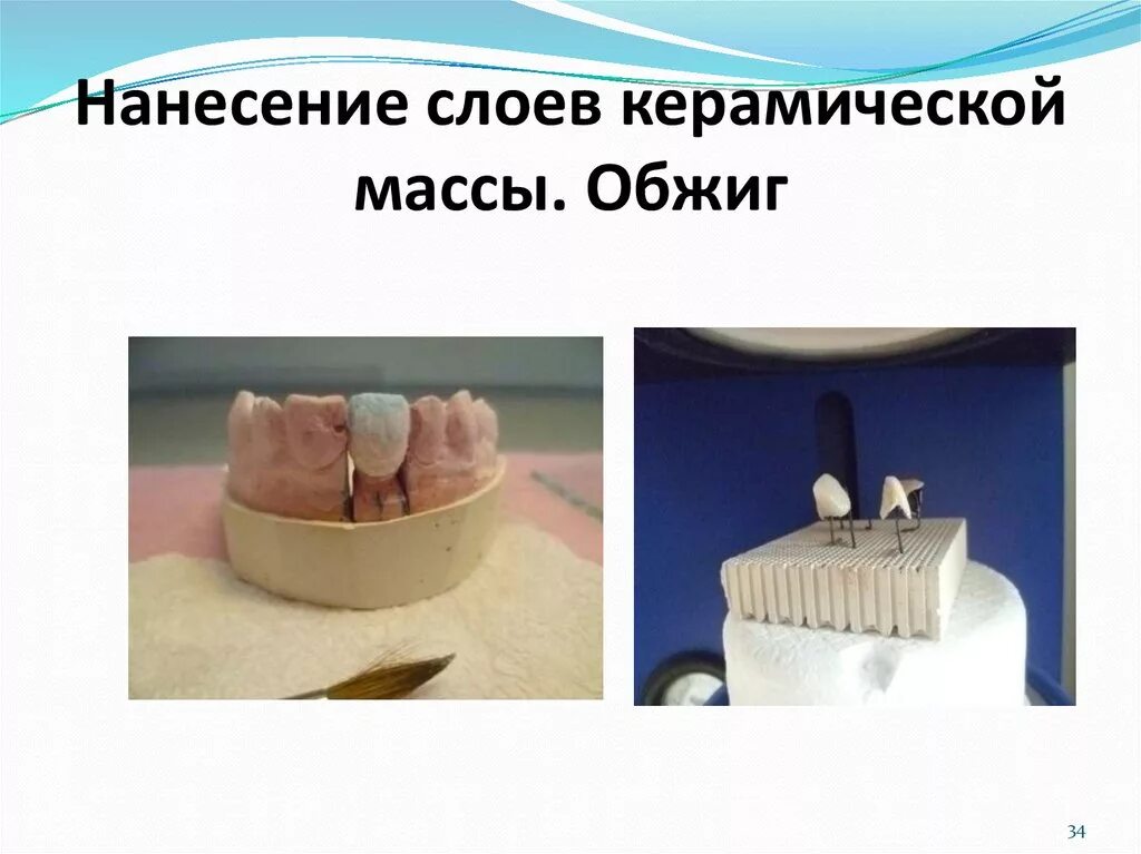 Нанесение керамики на зубы. Нанесение опакового слоя керамики. Металлокерамика этапы изготовления. Глазурование керамики в стоматологии. Нанесение керамической массы.
