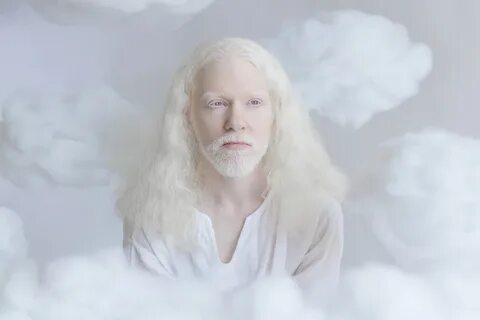 Люди альбиносы (72 фото) .