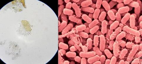 Serratia marcescens