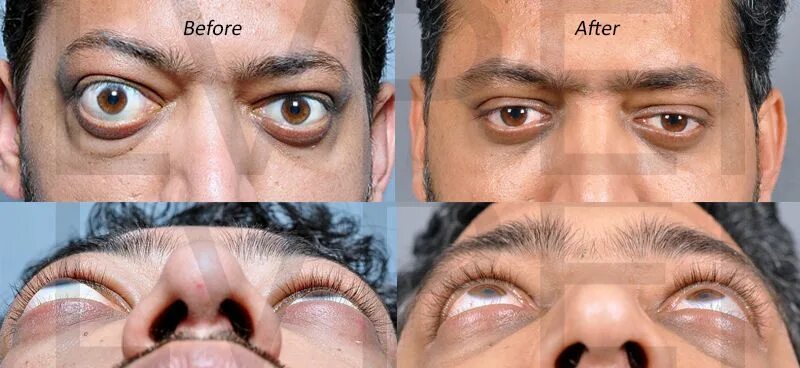 Cf happy eyeballs failure
