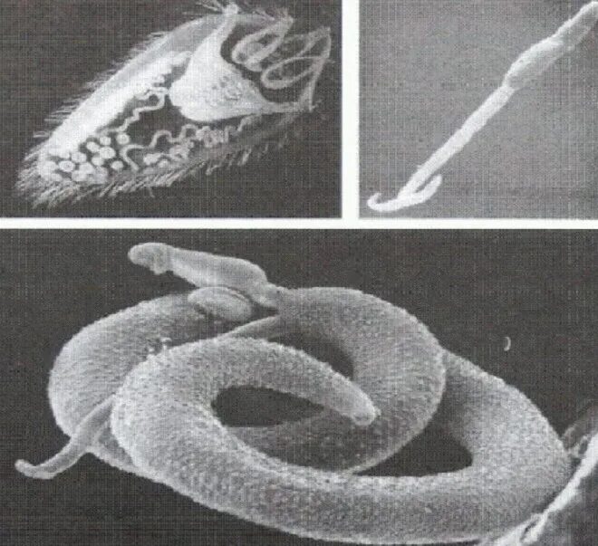 Гермафродитами являются черви. Паразитические формы круглых червей. Простейшие паразиты гельминты. Амфиды нематод. Плоские и круглые черви гельминты.