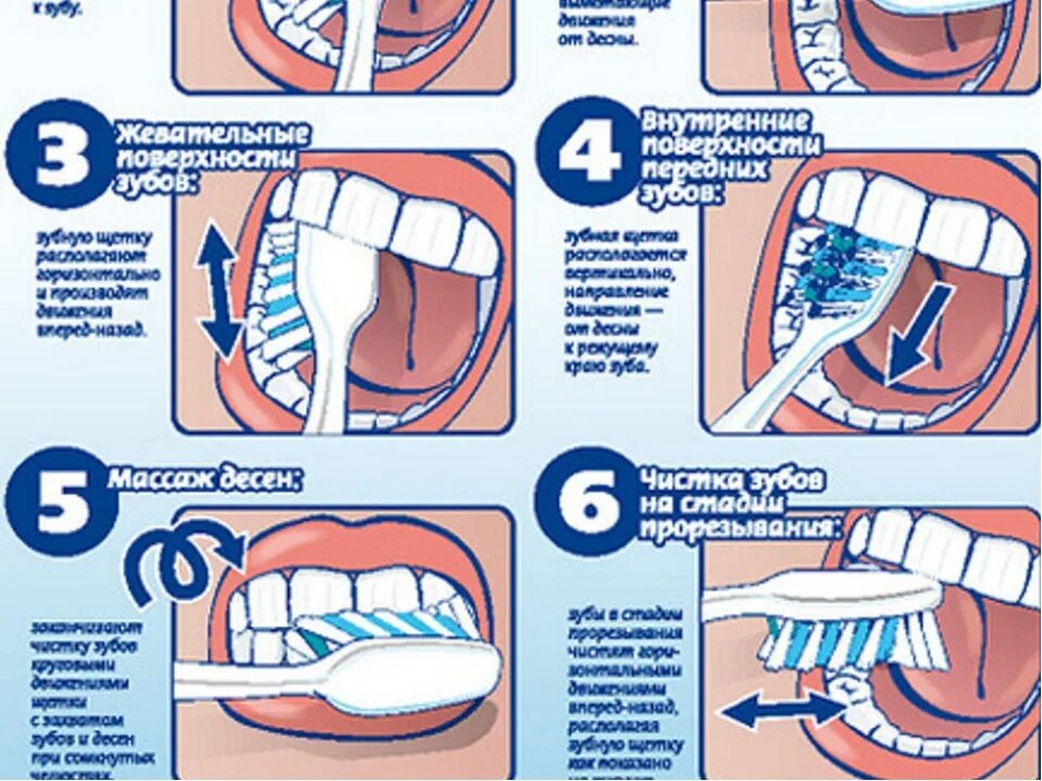 Когда лучше чистить зубы. Схема правильной чистки зубов. Правельна схема чистки зубов. Стандартный метод чистки зубов схема. Схема чистки зубов электрической щеткой.