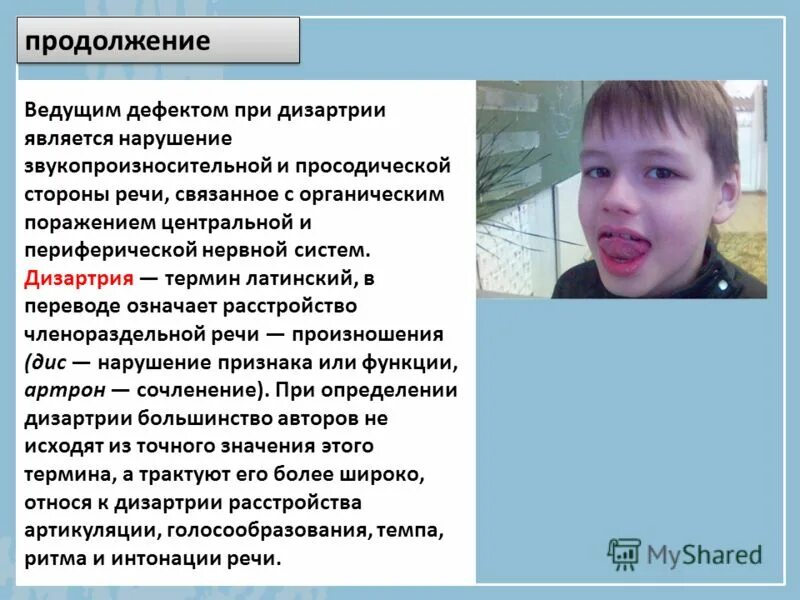Дизартрия языка у детей. Дизартрия языка у детей. Дизартрия языка у детей. Дизартрия языка у детей. Псевдобульбарная дизартрия у детей.