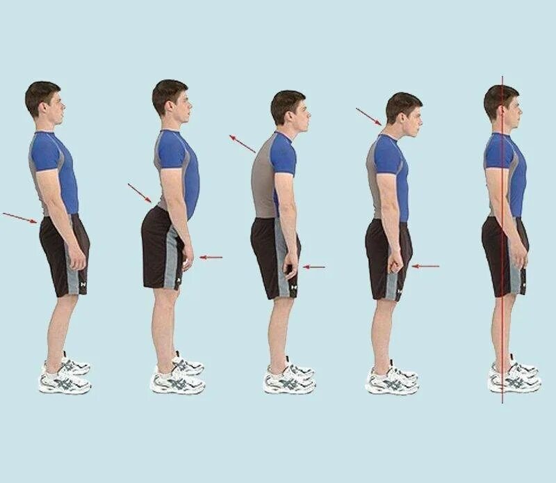 Прямо насколько. Лордоз поясничного отдела позвоночника упражнения. Поясничный лордоз упражнения для исправления. Упражнения для выпрямления осанки. Осанка нарушение осанки.
