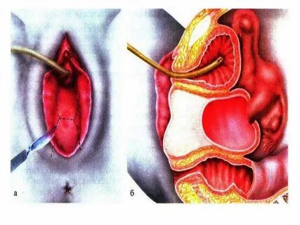 Мен колготки киген әйелдің ішіне кірдім