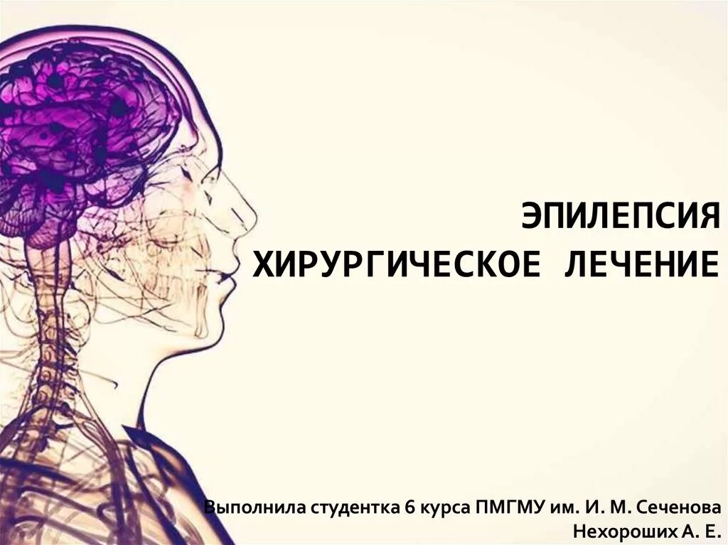 Исследование эпилепсии. Хирургическое лечение эпилепсии. Хирургическое лечение эпилепсии у детей. Хирургическое лечение эпилепсии у взрослых.