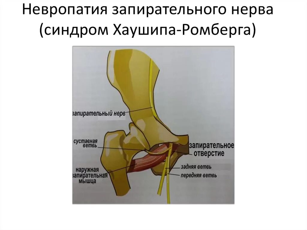 Невропатия полового нерва. Синдром поражения запирательного нерва. Синдром сдавления запирательного нерва. Канал запирательного нерва. Бедренный и запирательный нерв.