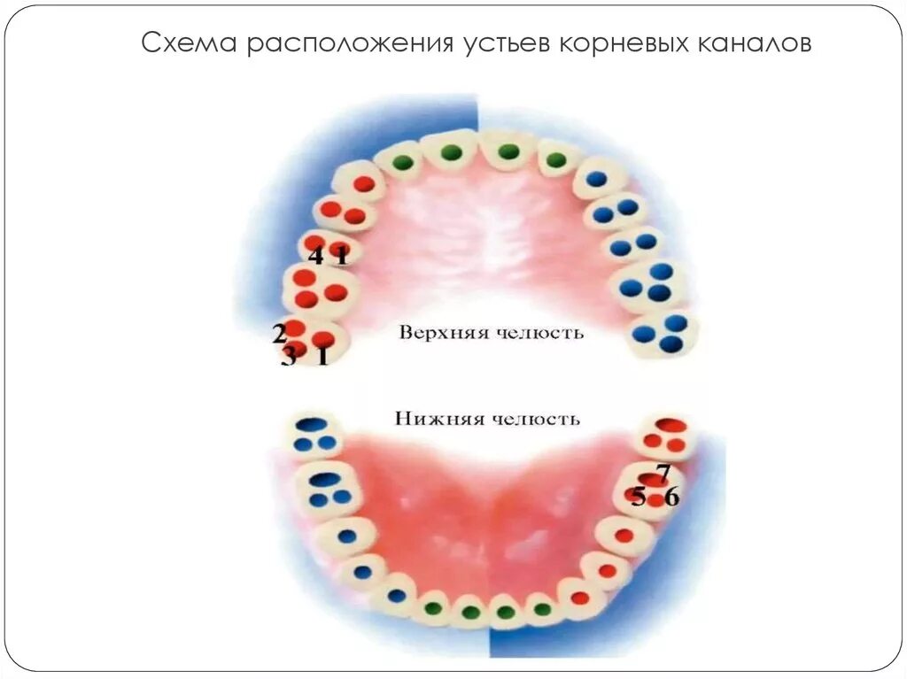 Топография устьев корневых каналов 26 зуба. Топография корневых каналов 16 зуба. Проекции устьев корневых каналов схема. Расположение устьев корневых каналов в 16 зубе.