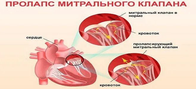 Где находится митральный клапан в сердце человека Лекции по Анатомии сх животных. Сердечно сосудистая система
