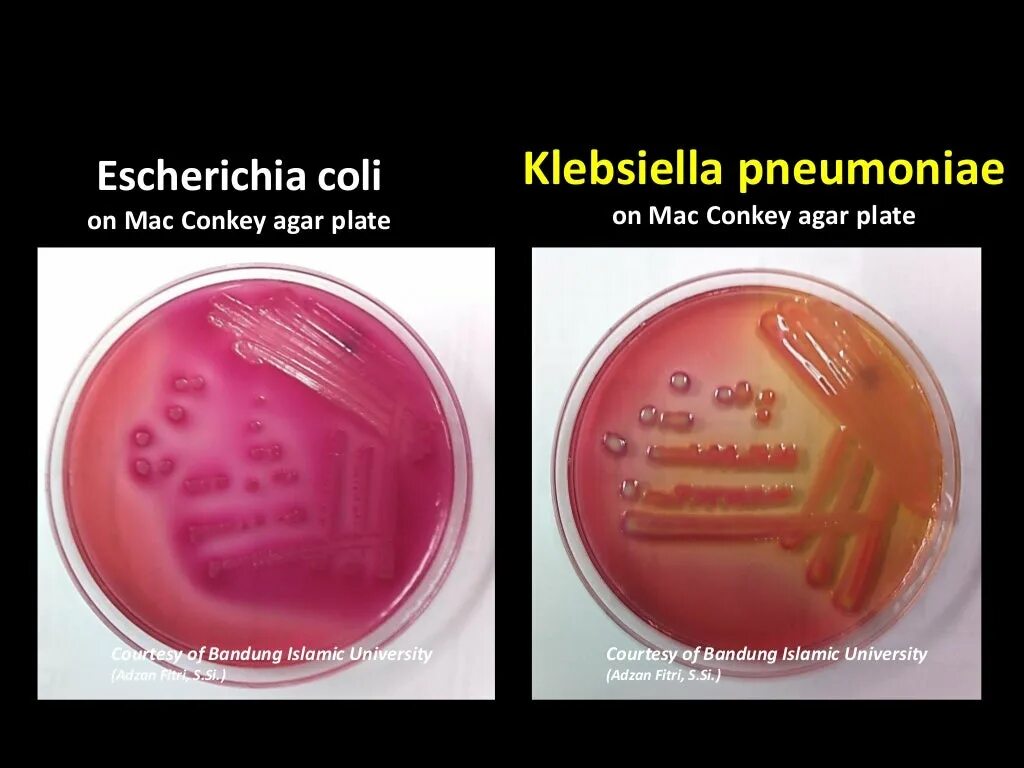 Клебсиелла микробиология. Klebsiella pneumoniae культуральные свойства. Escherichia coli что это у мужчин