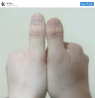 Почему большие пальцы