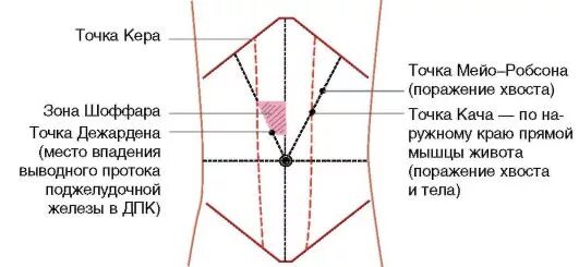 поджелудочная железа точки пальпации. методика пальпации поджелудочной железы. пальпация по гроту поджелудочной. точка дежардена и мейо-робсона. точка мейо робсона 2.
