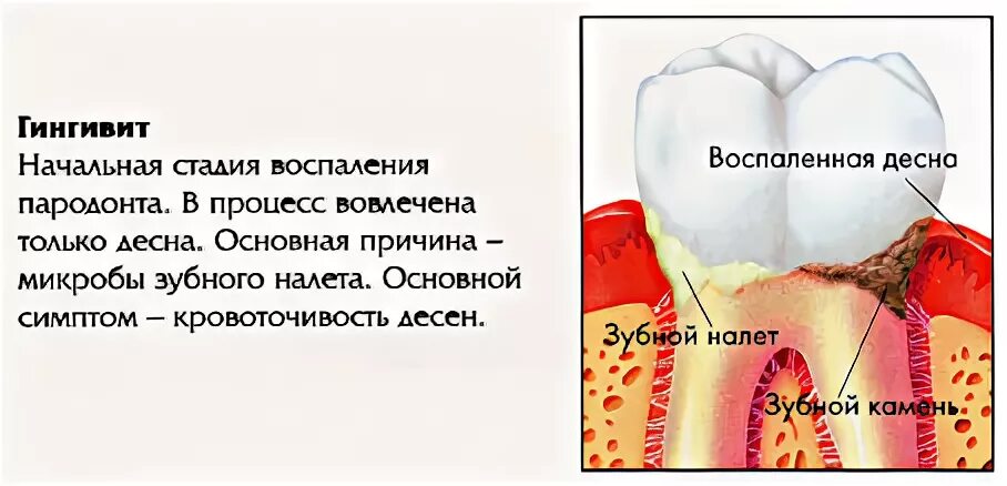 Начальная стал
