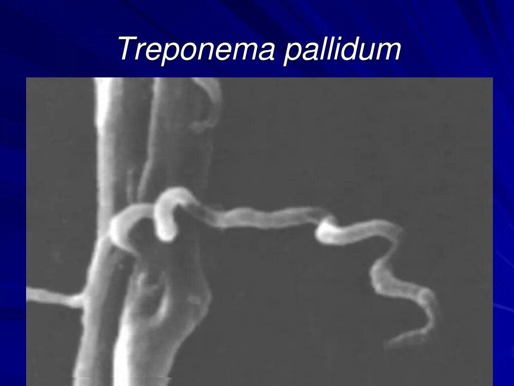 Treponema pallidum под микроскопом. Бледная трипонема спирохета или трепонема. Трепонема паллидум Тип дыхания. Бледная трепонема (Treponema pallidum).