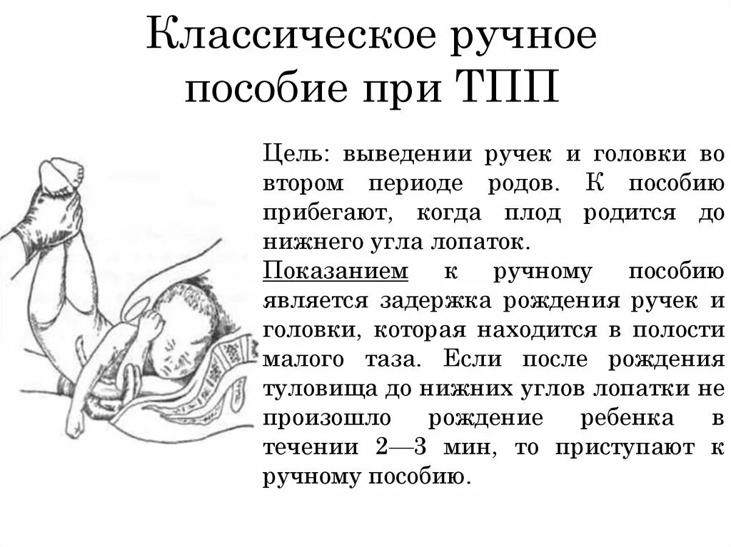 Тазовое предлежание показание. Пособие родов при тазовом предлежании. Классическое ручное пособие при ножном предлежании. Техника классического ручного пособия при тазовом предлежании. Методика классического ручного пособия при тазовом предлежании.