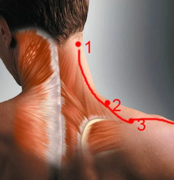 Шишка после массажа. Трапециевидная мышца (m. Trapezius). Мышцы шейно-воротниковой зоны анатомия. Болит спина и шея.