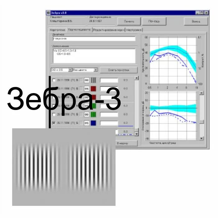 Zebra программа для печати. Программа зебра. программа зебра визоконтрастометрия. зебра 3d программа. программа зебра ведущие.