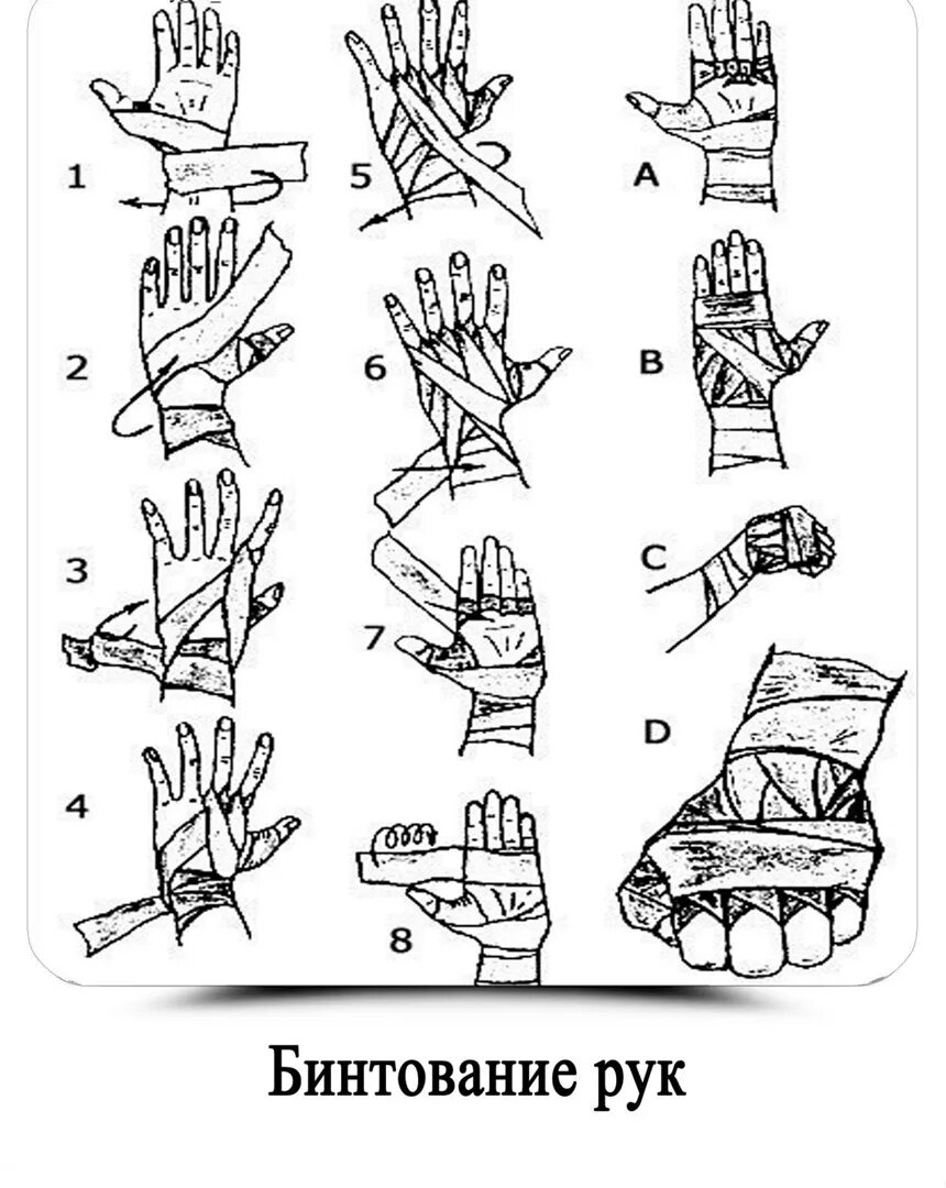 Повязка на руку схема. Схема бинтования лучезапястного сустава. Схема перевязки кисти руки. Схема намотки боксерских бинтов 2.5 м. Бинтование кисти руки бинтом.