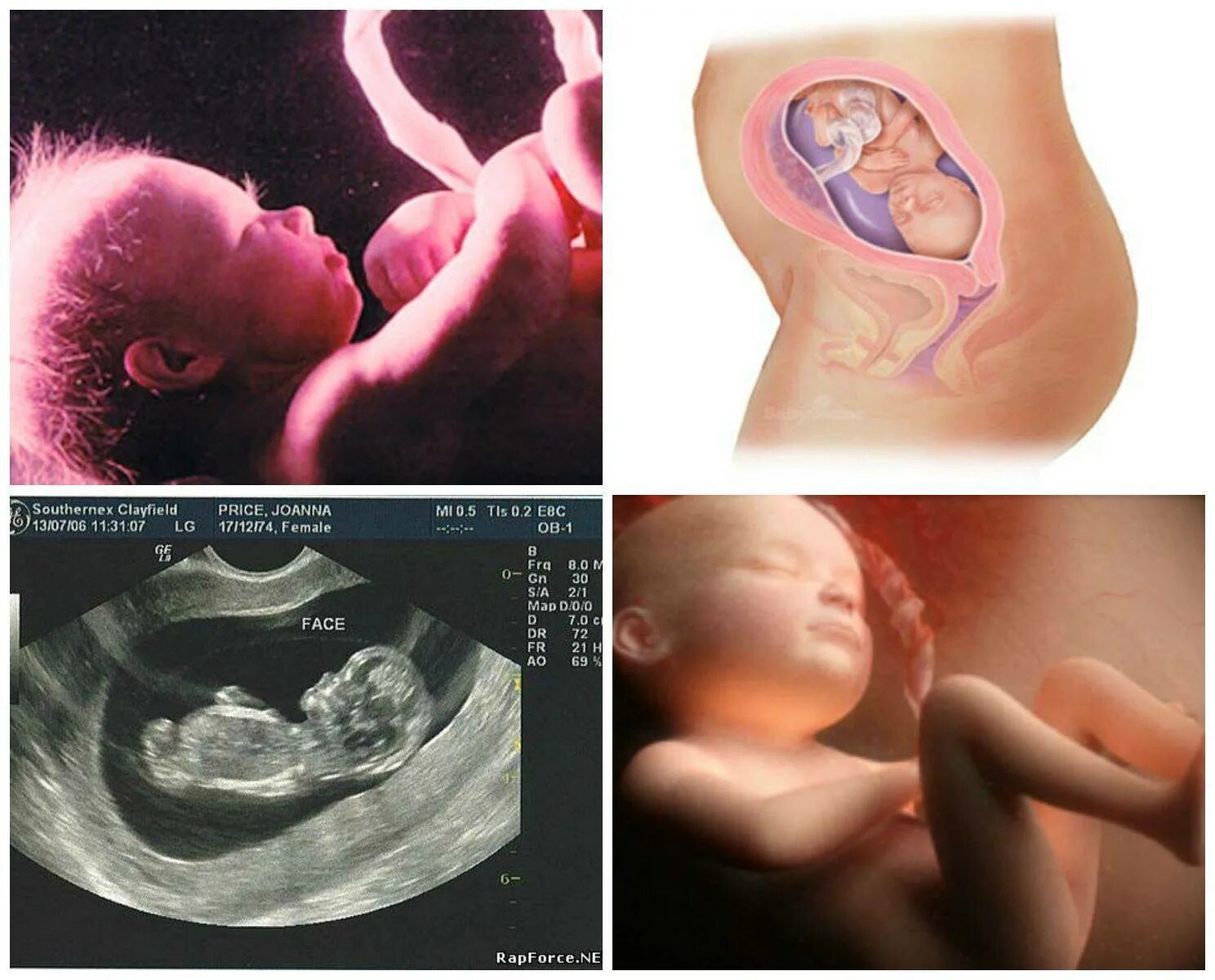 25 недель триместр. 27 Неделя беременности фото плода. Ребенок на 26 неделе беременности УЗИ. 26 Неделя беременности фото плода. Беременность 26-27 недель фото плода.
