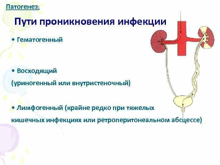 Острый пиелонефрит пути проникновения инфекции. Гематогенный нисходящий пиелонефрит. Гематогенный путь проникновения инфекции в почки. Уриногенный путь инфицирования при пиелонефрите.