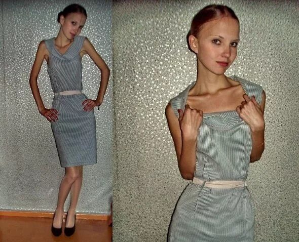 Девушки весом 40 кг. Обычная фигура девочки подростка. Вес 35. Худые девушки. Похудение до анорексии.