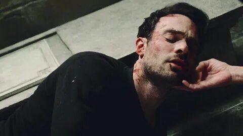 He hurt his leg when he